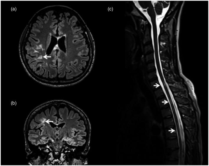 https://cdn.ncbi.nlm.nih.gov/pmc/blobs/28ac/8561692/8637db214b8e/CEI-206-266-g004.jpg