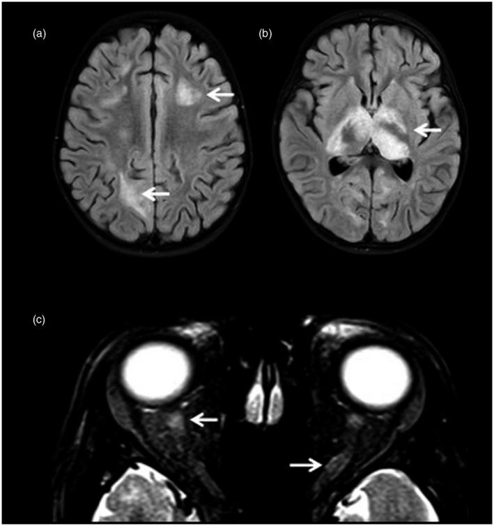 https://cdn.ncbi.nlm.nih.gov/pmc/blobs/28ac/8561692/bbc602a646c1/CEI-206-266-g005.jpg