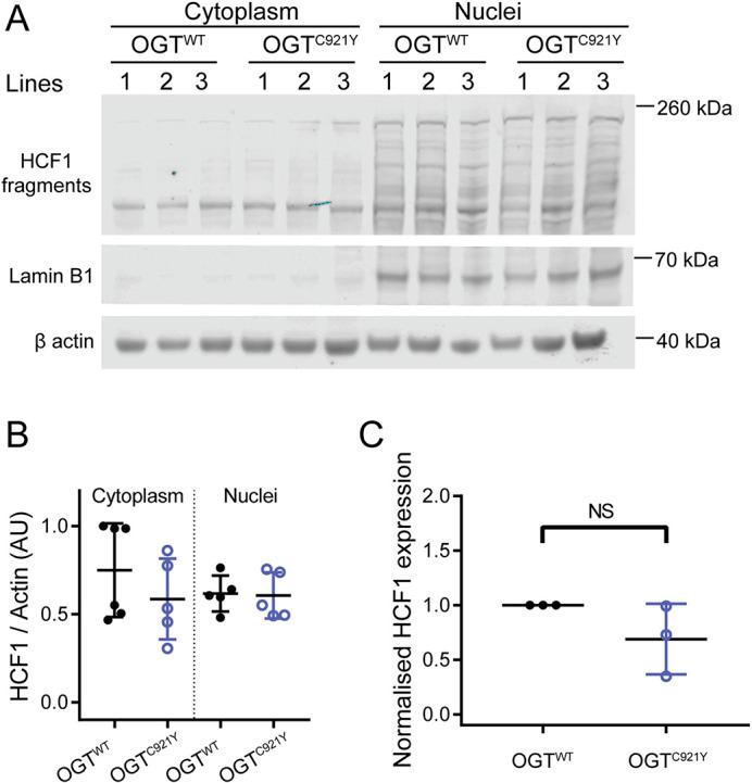 https://cdn.ncbi.nlm.nih.gov/pmc/blobs/28ae/10309585/6059ccb2d9d4/dmm-16-049132-g4.jpg