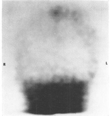 https://cdn.ncbi.nlm.nih.gov/pmc/blobs/28ae/494135/a0845490cce0/jnnpsyc00209-0005-a.jpg