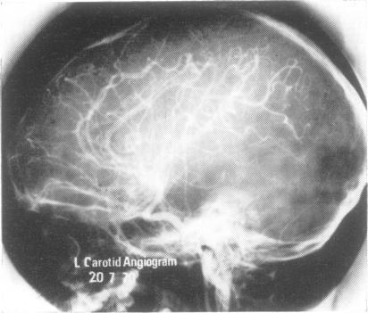 https://cdn.ncbi.nlm.nih.gov/pmc/blobs/28ae/494135/d3d1cface94b/jnnpsyc00209-0004-b.jpg