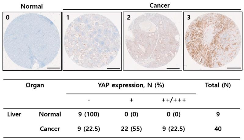 https://cdn.ncbi.nlm.nih.gov/pmc/blobs/28ae/8837083/166d52419fcc/ijms-23-01855-g001.jpg