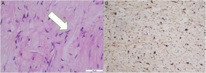 https://cdn.ncbi.nlm.nih.gov/pmc/blobs/28b6/11406796/8d62f5b8f47f/gr9.jpg