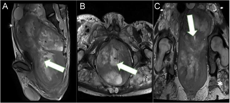 https://cdn.ncbi.nlm.nih.gov/pmc/blobs/28b6/11406796/a1b36da73f4d/gr6.jpg