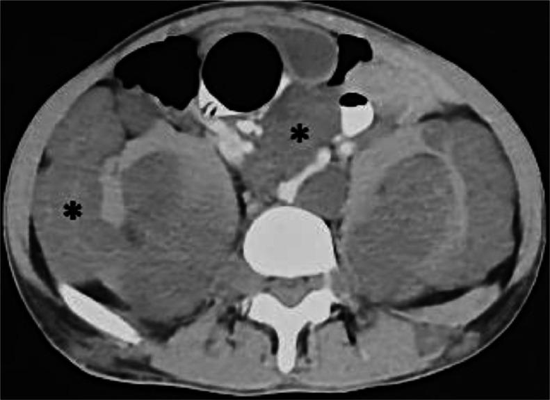https://cdn.ncbi.nlm.nih.gov/pmc/blobs/28b6/11406796/cdc16e0f3847/gr4.jpg