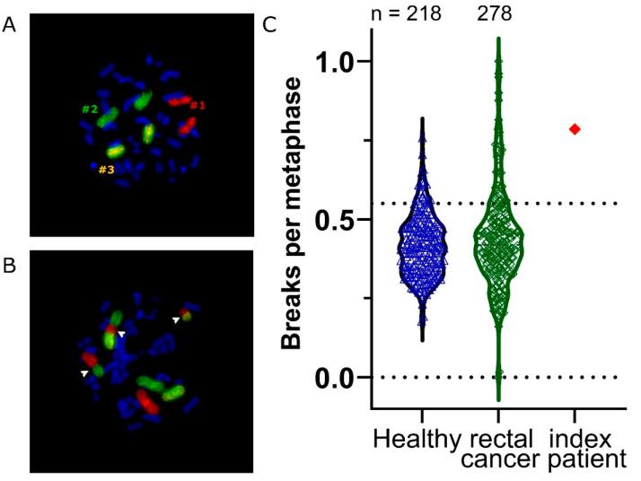 https://cdn.ncbi.nlm.nih.gov/pmc/blobs/28bc/9316541/36f43149a093/cancers-14-03520-g003.jpg