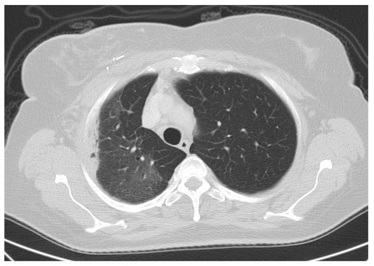 https://cdn.ncbi.nlm.nih.gov/pmc/blobs/28bc/9316541/594b5443f0fb/cancers-14-03520-g002.jpg
