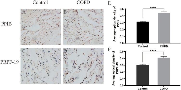 https://cdn.ncbi.nlm.nih.gov/pmc/blobs/28bf/12168939/879a6c5638b0/COPD-20-1865-g0005.jpg