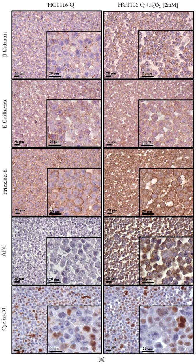 https://cdn.ncbi.nlm.nih.gov/pmc/blobs/28c1/8656656/f2e127c4cbad/cancers-13-06045-g007a.jpg
