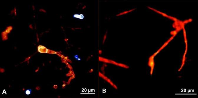 https://cdn.ncbi.nlm.nih.gov/pmc/blobs/28c8/3359816/8e94e1b0245a/ima-2-177-g001.jpg