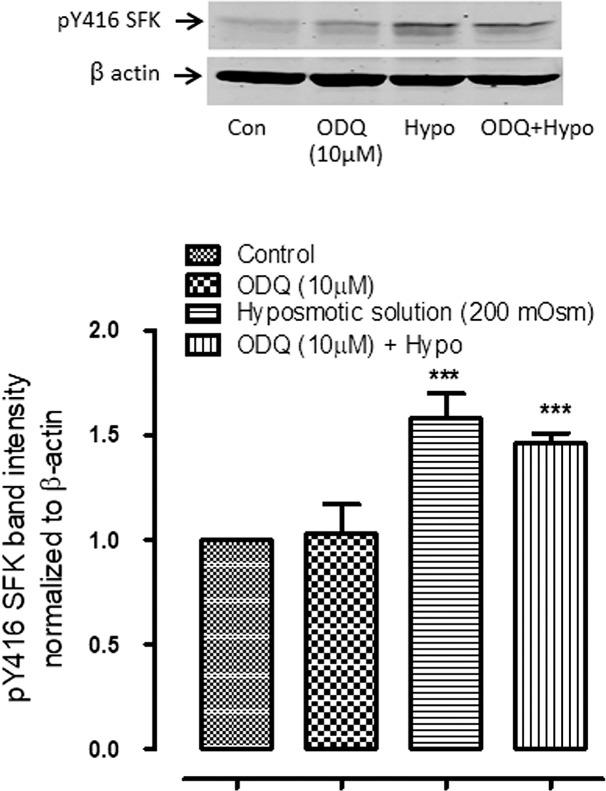 https://cdn.ncbi.nlm.nih.gov/pmc/blobs/28d5/6108779/0401ed08371a/i1552-5783-58-11-4447-f06.jpg