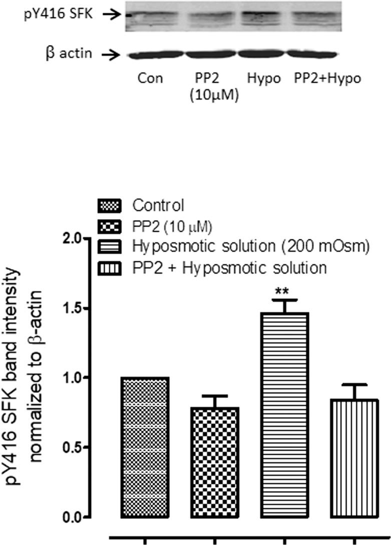 https://cdn.ncbi.nlm.nih.gov/pmc/blobs/28d5/6108779/13052375e389/i1552-5783-58-11-4447-f05.jpg