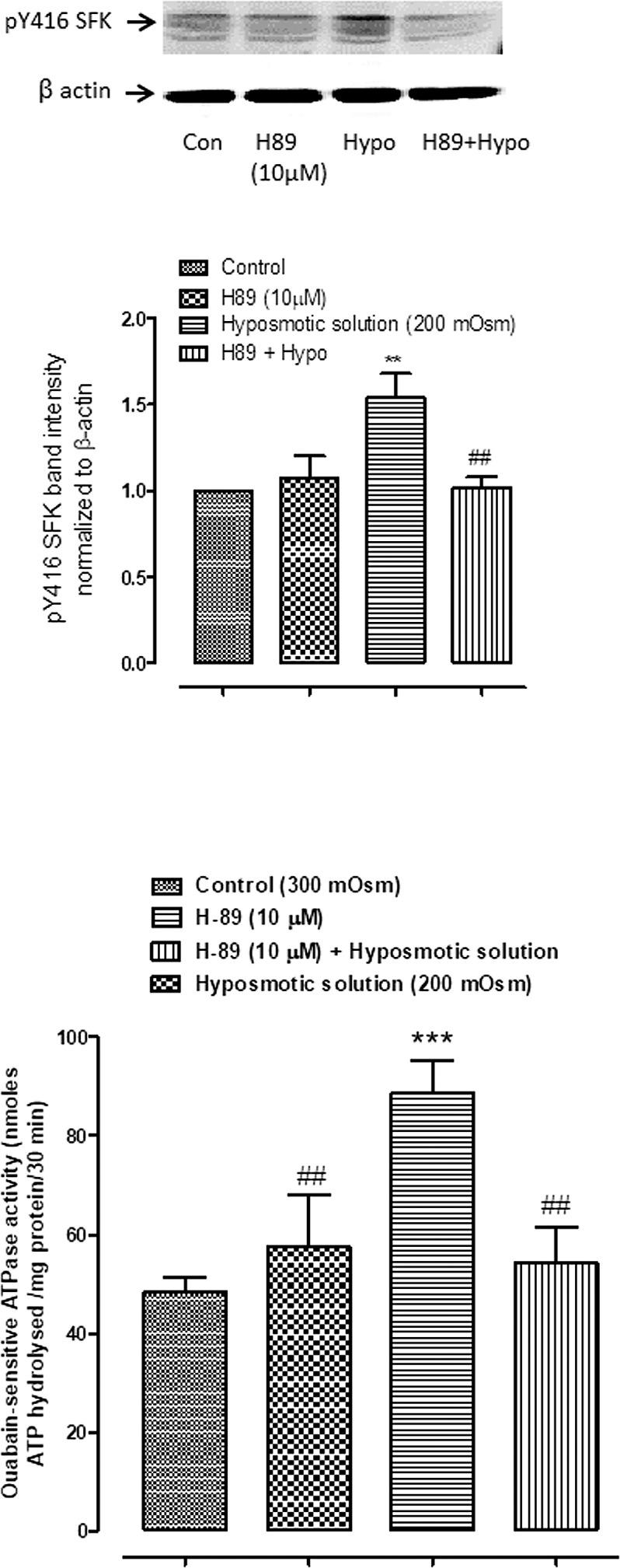 https://cdn.ncbi.nlm.nih.gov/pmc/blobs/28d5/6108779/d3f07bec03d0/i1552-5783-58-11-4447-f02.jpg
