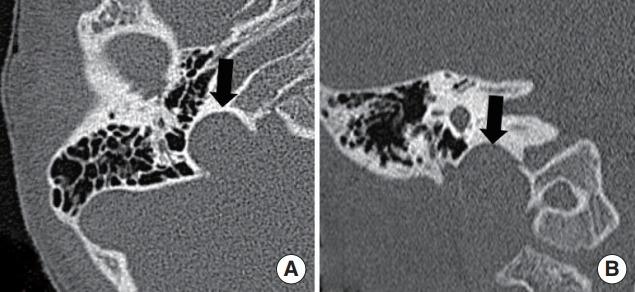 https://cdn.ncbi.nlm.nih.gov/pmc/blobs/28d6/6453793/2706ba57d306/ceo-2018-00857f5.jpg