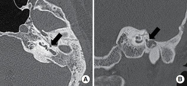 https://cdn.ncbi.nlm.nih.gov/pmc/blobs/28d6/6453793/3a5f2c216a5d/ceo-2018-00857f4.jpg