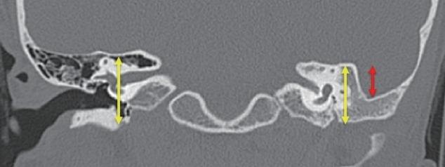 https://cdn.ncbi.nlm.nih.gov/pmc/blobs/28d6/6453793/cc5d8de9b935/ceo-2018-00857f1.jpg