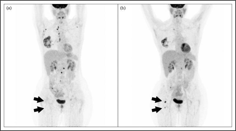 https://cdn.ncbi.nlm.nih.gov/pmc/blobs/28d7/10852035/84615a310868/coonc-34-606-g002.jpg