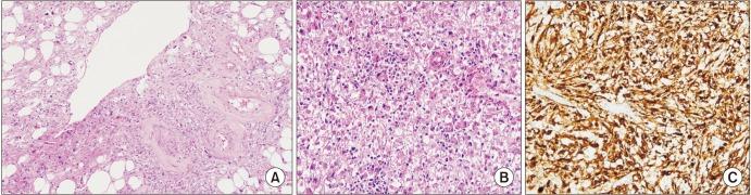 https://cdn.ncbi.nlm.nih.gov/pmc/blobs/28dd/6215778/356b189f5cab/icu-59-357-g001.jpg