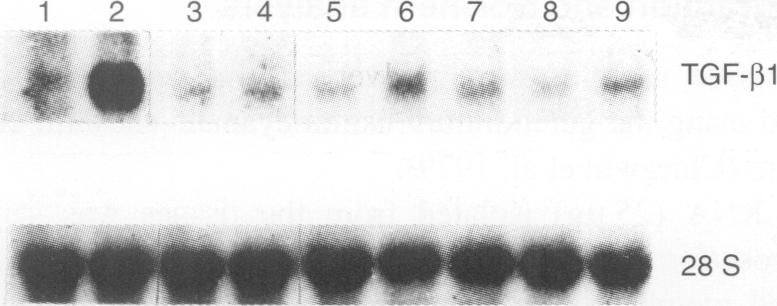 https://cdn.ncbi.nlm.nih.gov/pmc/blobs/28de/2150151/3172ad43fd88/brjcancer00084-0068-a.jpg