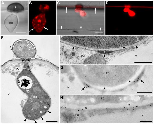 https://cdn.ncbi.nlm.nih.gov/pmc/blobs/28de/3320591/1cae7156ad44/ppat.1002643.g005.jpg