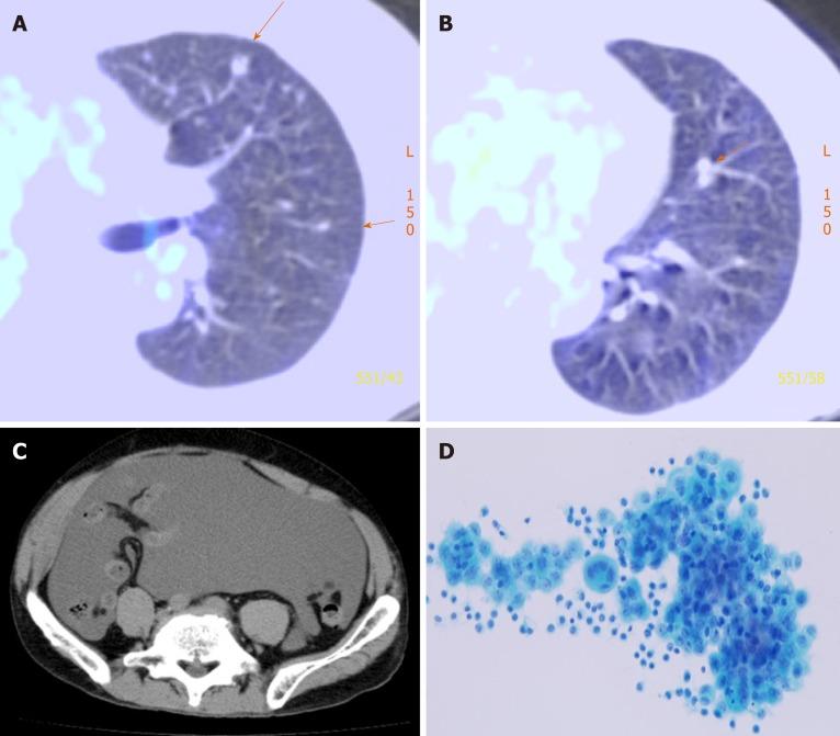 https://cdn.ncbi.nlm.nih.gov/pmc/blobs/28e5/6906570/07015ff3c81f/WJCC-7-4036-g001.jpg
