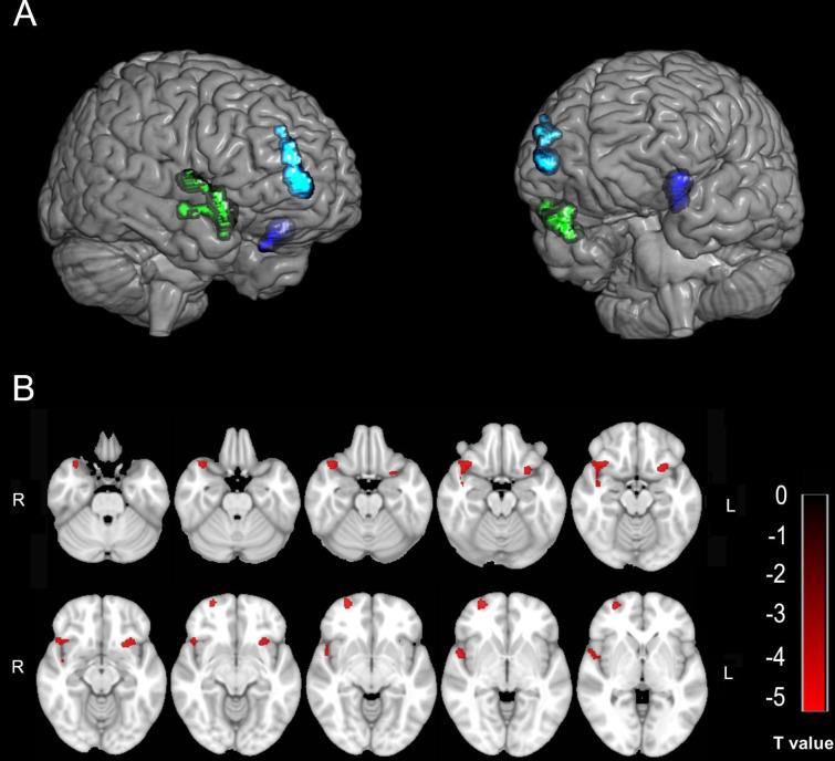 https://cdn.ncbi.nlm.nih.gov/pmc/blobs/28e6/10569206/80c99bceca9f/peerj-11-16172-g001.jpg