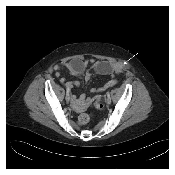 https://cdn.ncbi.nlm.nih.gov/pmc/blobs/28eb/3639685/85c0975131fe/CRIM.MEDICINE2013-197561.001.jpg