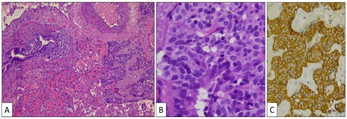 https://cdn.ncbi.nlm.nih.gov/pmc/blobs/28f3/11270357/8ab7df1f8450/clinpract-14-00116-g005.jpg