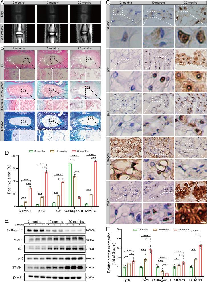 https://cdn.ncbi.nlm.nih.gov/pmc/blobs/28f5/12049776/bfdc859a9216/10020_2025_1220_Fig2_HTML.jpg