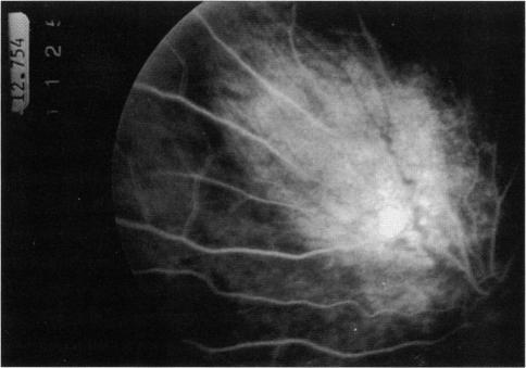 https://cdn.ncbi.nlm.nih.gov/pmc/blobs/28f6/1312089/09450dfd0c27/taos00005-0104-a.jpg