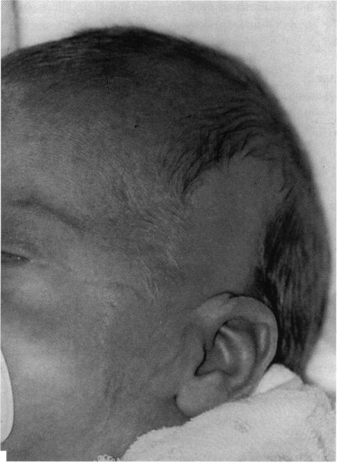 https://cdn.ncbi.nlm.nih.gov/pmc/blobs/28f6/1312089/1b323d4015eb/taos00005-0102-a.jpg