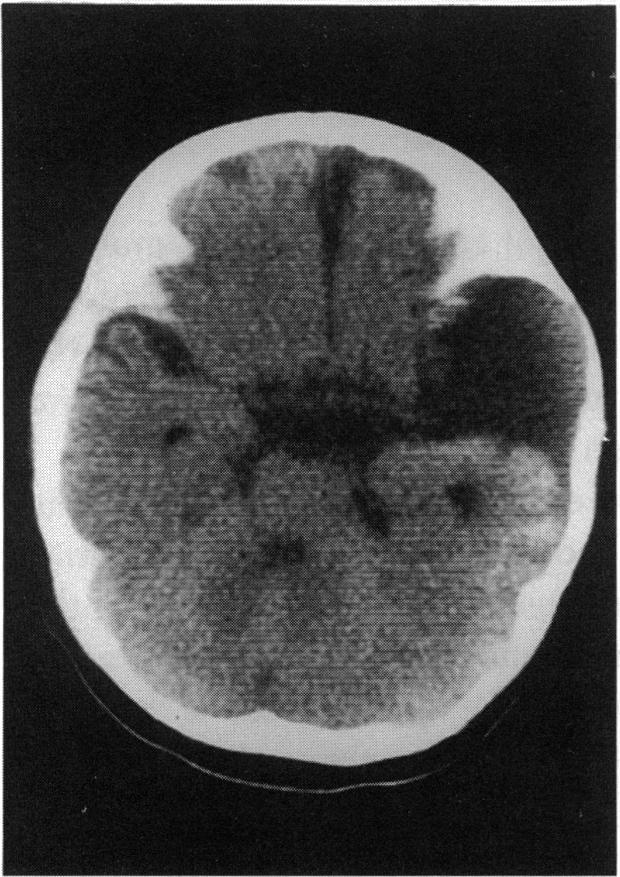 https://cdn.ncbi.nlm.nih.gov/pmc/blobs/28f6/1312089/77a2c4c16909/taos00005-0097-a.jpg