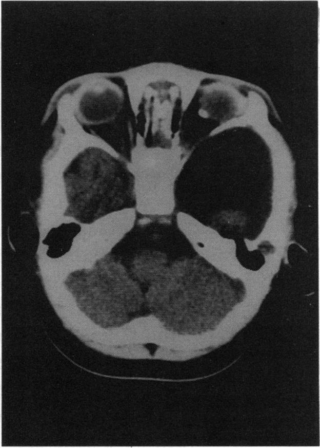 https://cdn.ncbi.nlm.nih.gov/pmc/blobs/28f6/1312089/8c101198c5a8/taos00005-0097-b.jpg