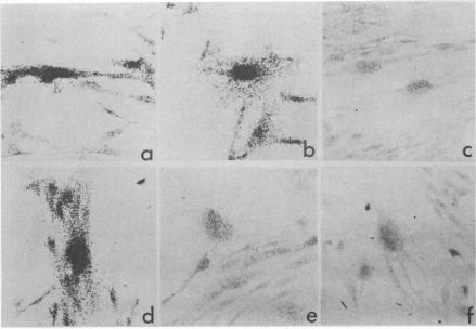 https://cdn.ncbi.nlm.nih.gov/pmc/blobs/28f6/1685391/2eb6e60da2ab/ajhg00208-0057-a.jpg