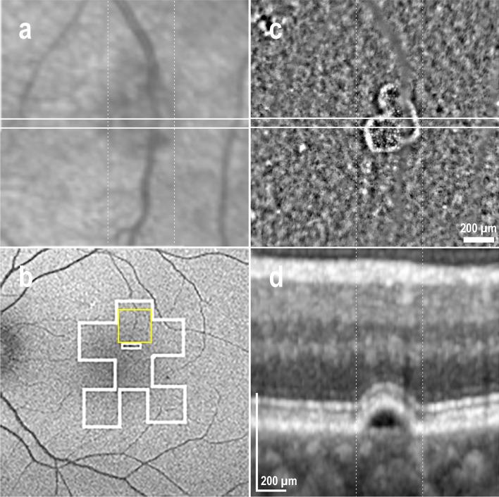 https://cdn.ncbi.nlm.nih.gov/pmc/blobs/28fb/11176374/7b05c7a07d33/41598_2024_64524_Fig4_HTML.jpg