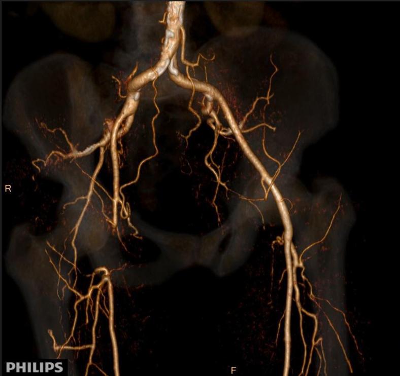 https://cdn.ncbi.nlm.nih.gov/pmc/blobs/28fe/10273281/aca4405adab3/gr5.jpg