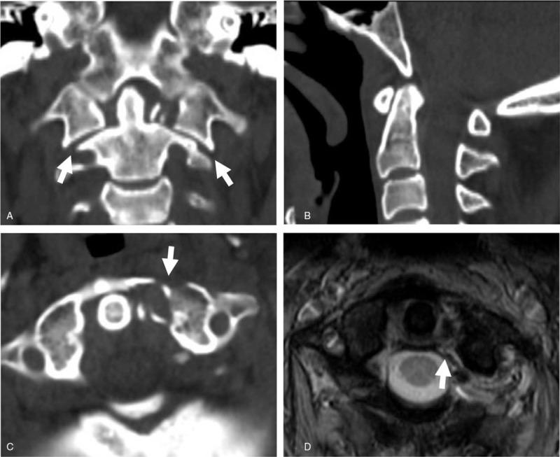https://cdn.ncbi.nlm.nih.gov/pmc/blobs/28fe/6739003/28fd1e5c6b14/medi-98-e17077-g005.jpg