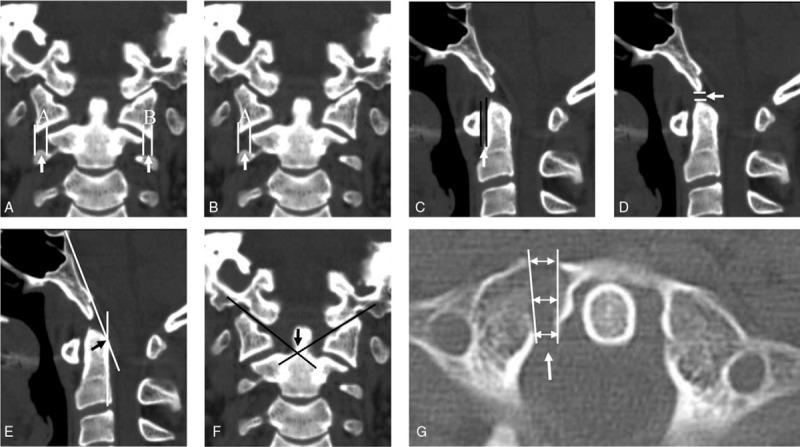 https://cdn.ncbi.nlm.nih.gov/pmc/blobs/28fe/6739003/91a174e3986c/medi-98-e17077-g001.jpg