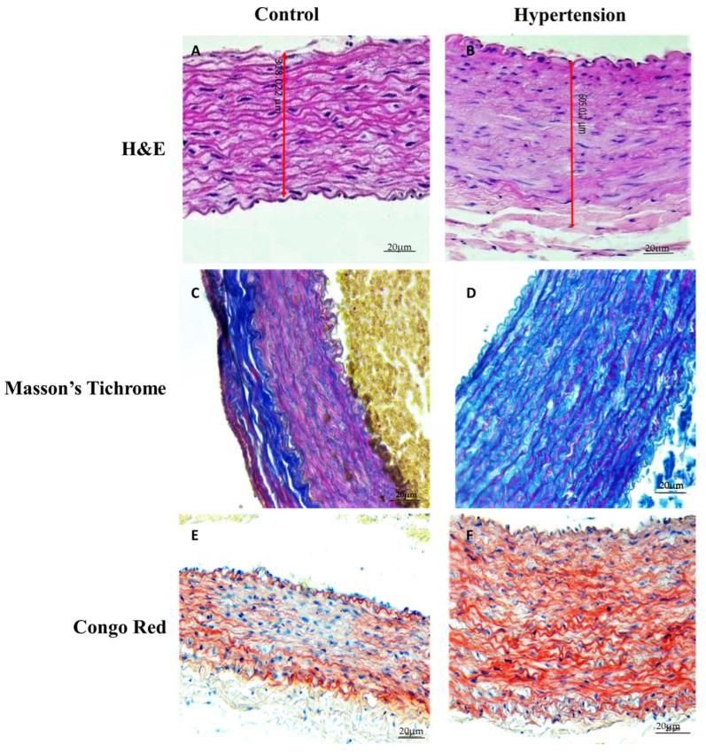 https://cdn.ncbi.nlm.nih.gov/pmc/blobs/2906/9605210/f1db48d851a7/jpm-12-01602-g002.jpg