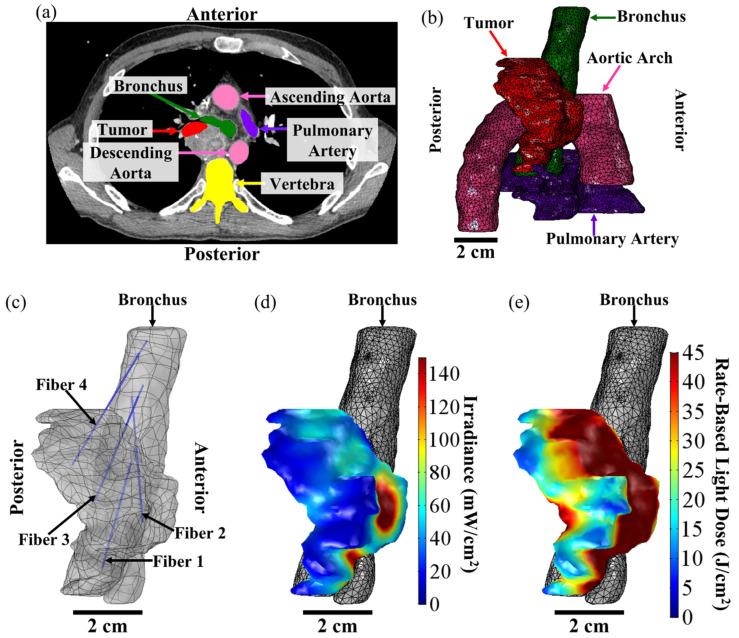 https://cdn.ncbi.nlm.nih.gov/pmc/blobs/290a/10177073/6b40399ba697/cancers-15-02636-g005.jpg