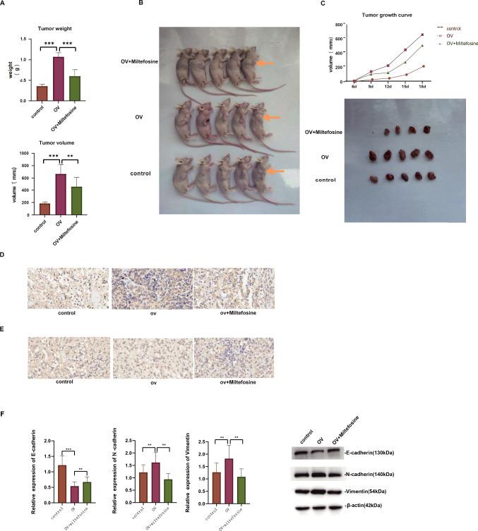 https://cdn.ncbi.nlm.nih.gov/pmc/blobs/2912/11923034/f1b5a58807fd/10238_2025_1622_Fig5_HTML.jpg
