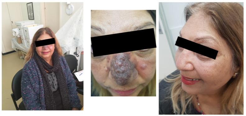 https://cdn.ncbi.nlm.nih.gov/pmc/blobs/2913/10892631/36cf92809d14/pharmacy-12-00030-g004.jpg