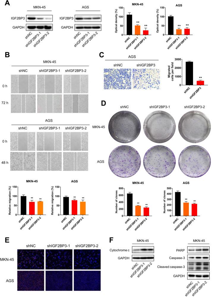 https://cdn.ncbi.nlm.nih.gov/pmc/blobs/2913/10917814/b91901f15ff7/41419_2024_6566_Fig2_HTML.jpg