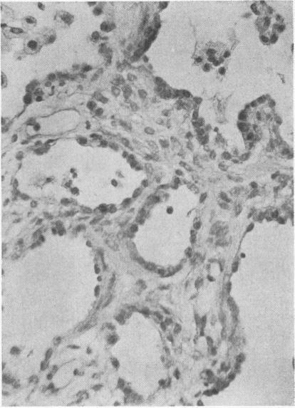 https://cdn.ncbi.nlm.nih.gov/pmc/blobs/2919/1347186/2aec42ad3299/jclinpath00434-0083-b.jpg