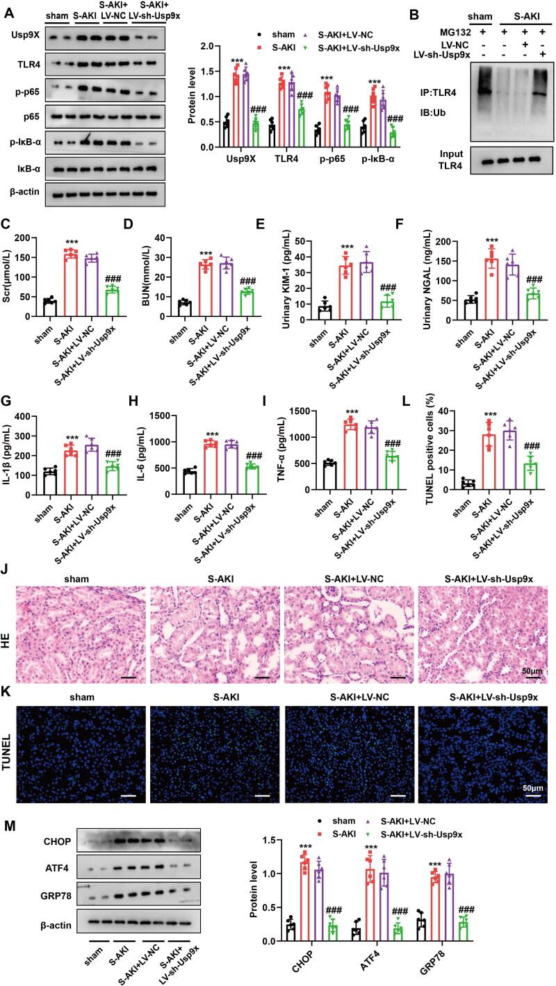 https://cdn.ncbi.nlm.nih.gov/pmc/blobs/291a/11182076/65c5d5c49dfd/IRNF_A_2361089_F0004_C.jpg
