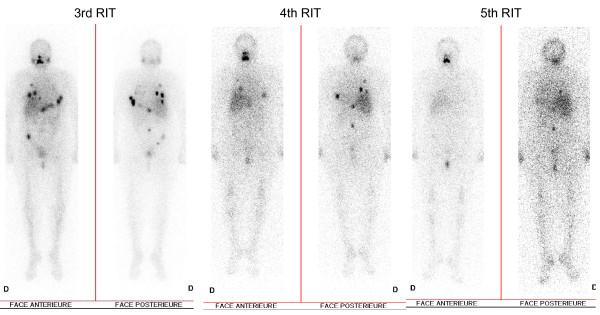 https://cdn.ncbi.nlm.nih.gov/pmc/blobs/291e/3214152/30c294514020/1752-1947-5-522-1.jpg