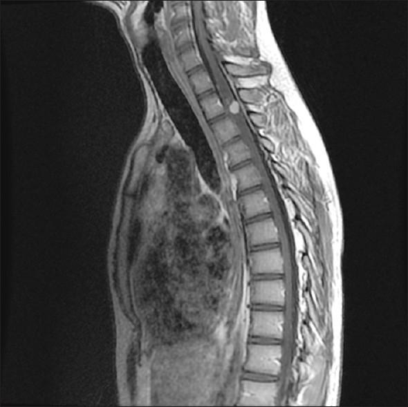 https://cdn.ncbi.nlm.nih.gov/pmc/blobs/2925/3279991/5c3a071d2a13/SNI-3-6-g004.jpg