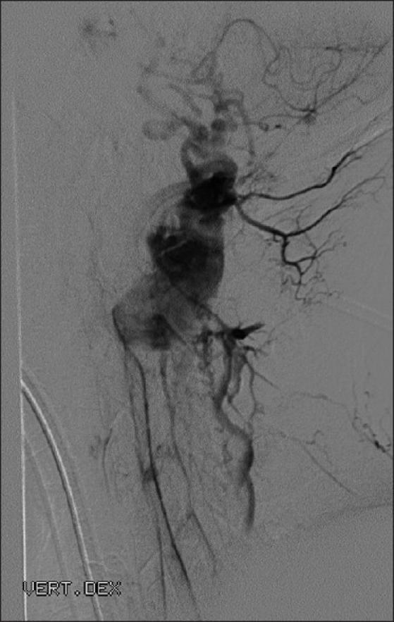 https://cdn.ncbi.nlm.nih.gov/pmc/blobs/2925/3279991/87b14e2fee40/SNI-3-6-g006.jpg