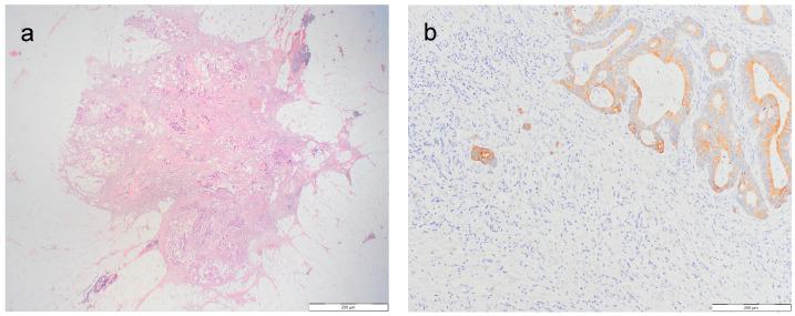 https://cdn.ncbi.nlm.nih.gov/pmc/blobs/2927/11084198/c0399550db6e/jcm-13-02583-g001a.jpg