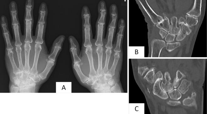 https://cdn.ncbi.nlm.nih.gov/pmc/blobs/2928/6443542/dd671ec7a80b/1349-7235-58-0737-g003.jpg